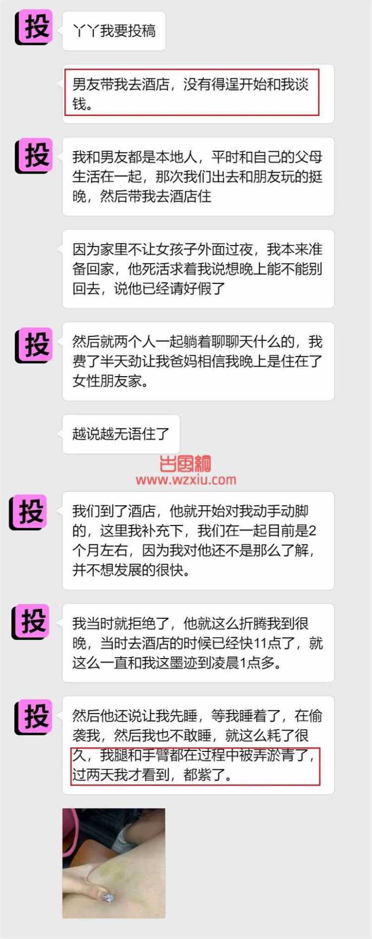 吃瓜！被男友弄至“淤青”事后还和我要钱？